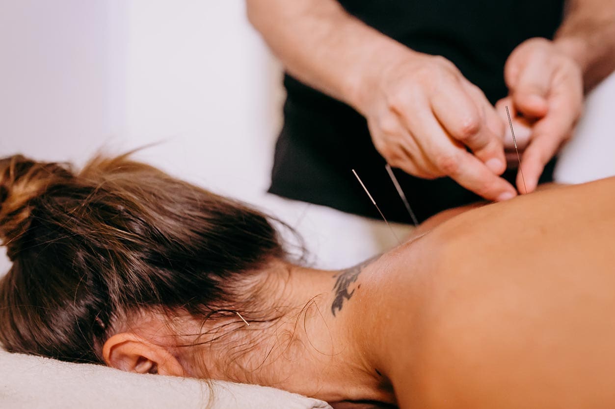 Acupuncture for Fertility Does it Work for Getting Pregnant